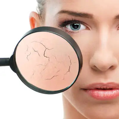 Dry cracked skin under magnification for herbal tea for cramps promoting blood circulation